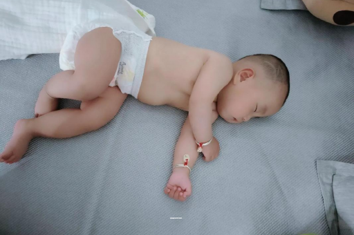 曹县宝宝上火有眼屎